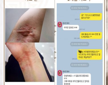 두드러기로 내원하신 20대 여성입니다