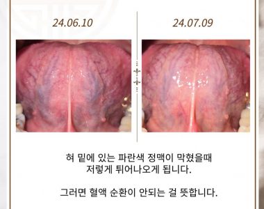 불면증으로 내원하신 50대 남성입니다(24.07.09)