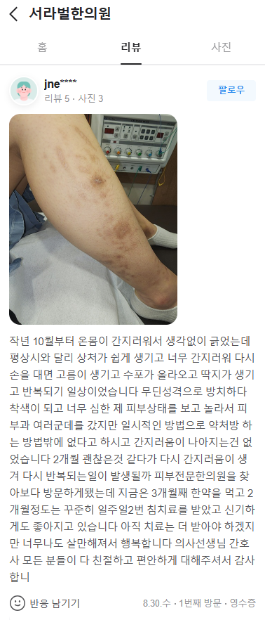 피부가려움증 치료후기