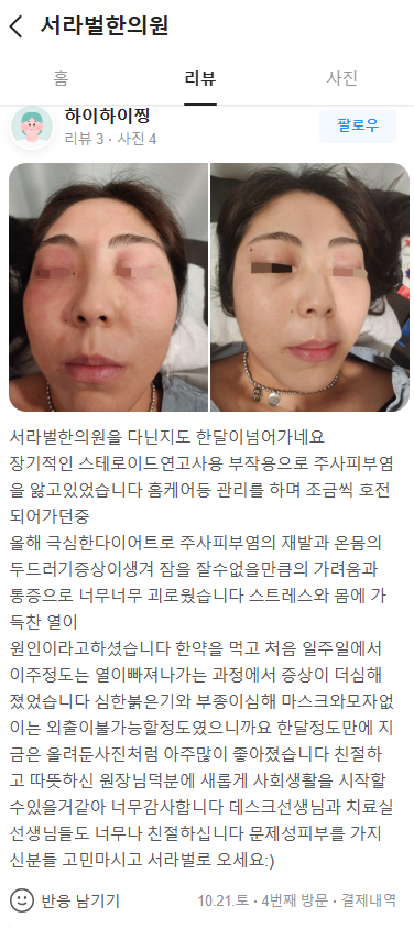 주사피부염 치료후기