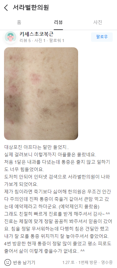 대상포진 진료후기