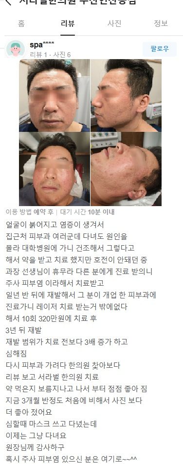 주사피부염 치료후기