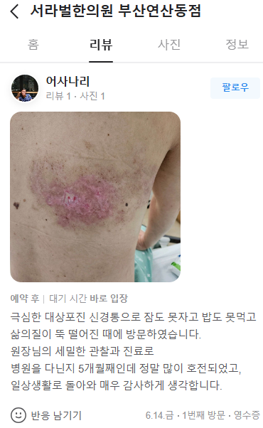 대상포진신경통 치료후기