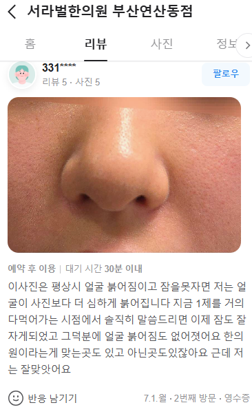 얼굴붉어짐 치료 후기