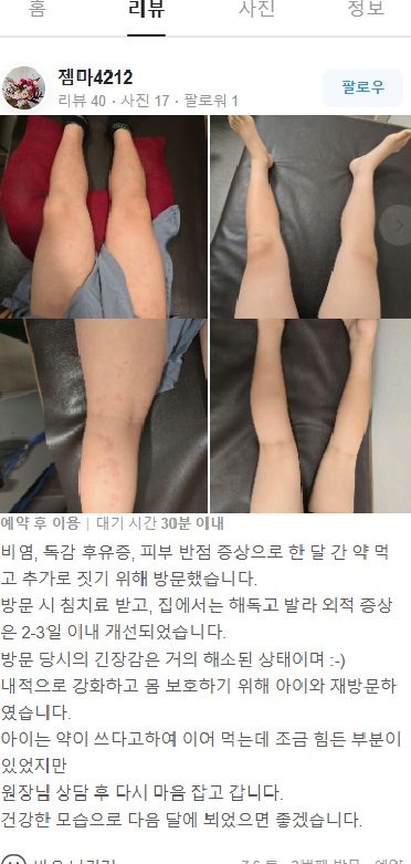 비염,독감후유증,피부발진 후기