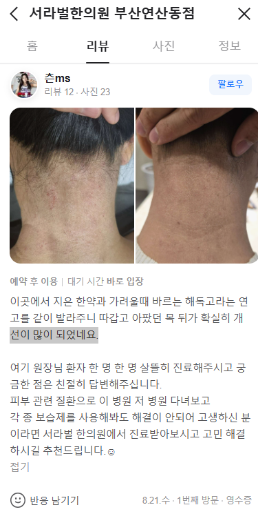 아토피 치료후기