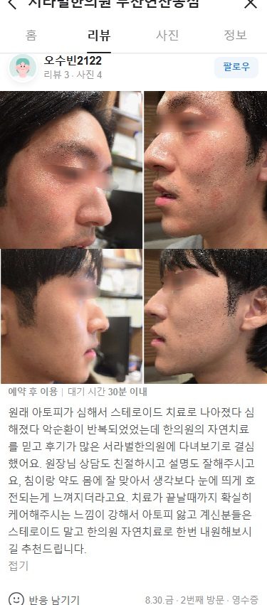 아토피 치료 후기