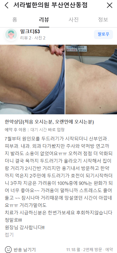 두드러기 치료 후기