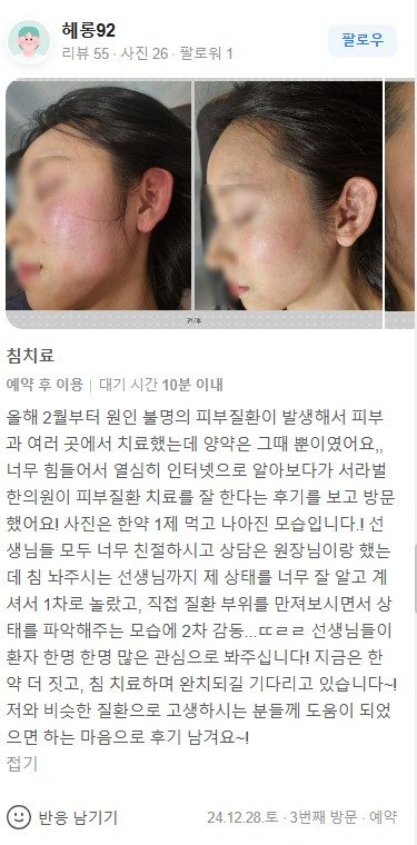 피부질환 치료 후기