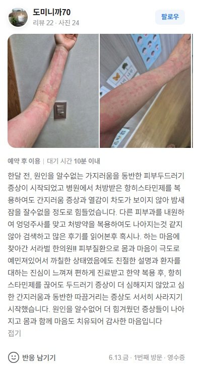 두드러기 치료후기
