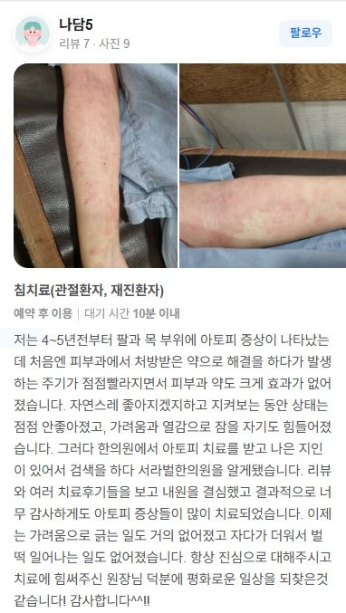 아토피 치료후기
