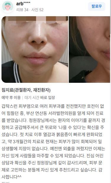 피부염 치료후기