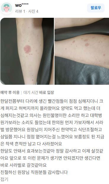 피부질환 치료후기