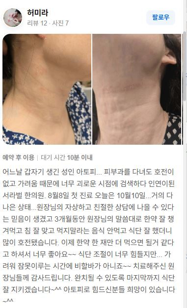 아토피 치료후기