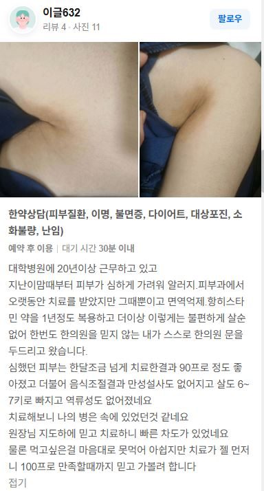 피부질환 치료후기