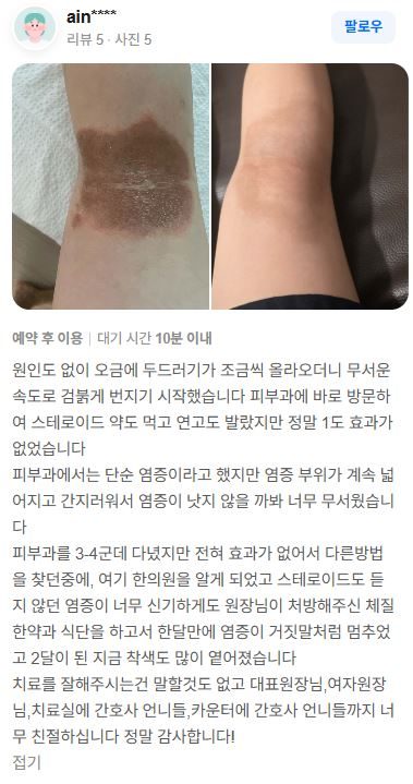 피부질환 치료후기