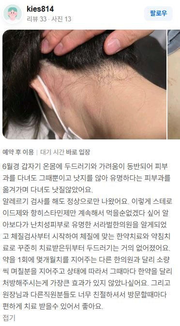 피부가려움 치료후기