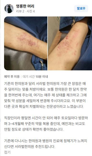 아토피 치료후기