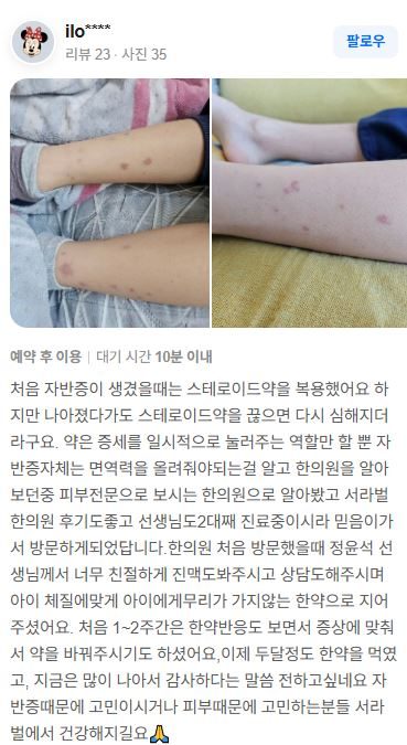자반증 치료후기