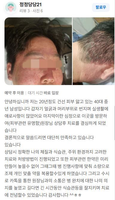건선 치료후기