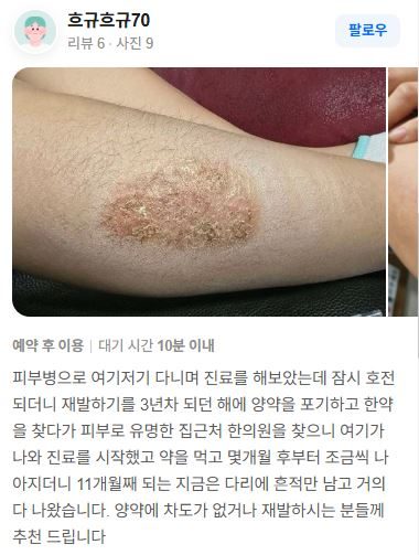 피부질환 치료후기
