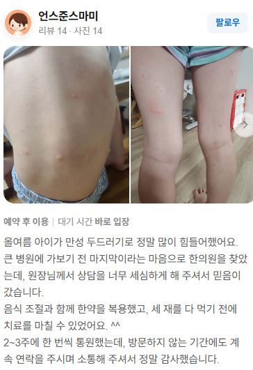 두드러기 치료후기