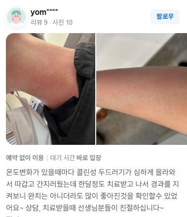 콜린성두드러기 치료후기