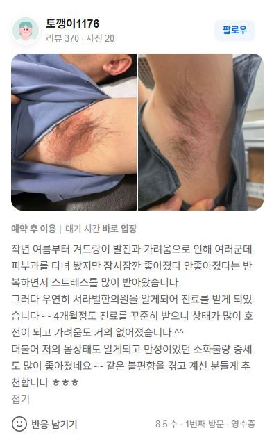 피부질환 치료후기