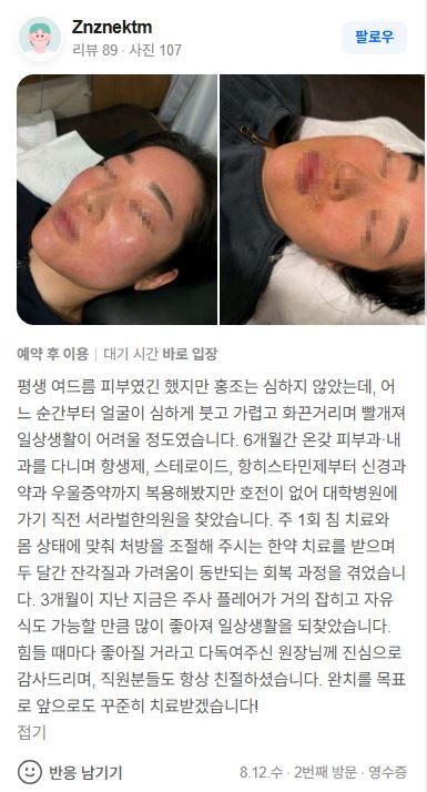 홍조 치료후기