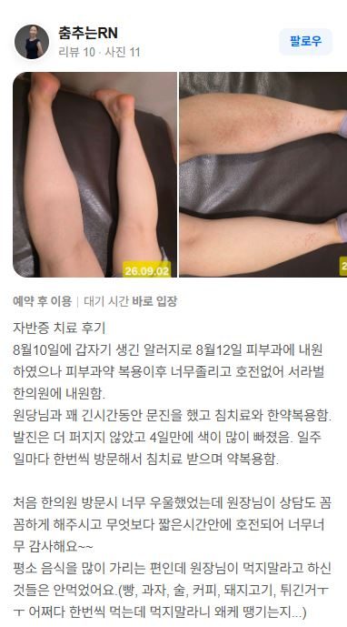 피부발진 치료후기
