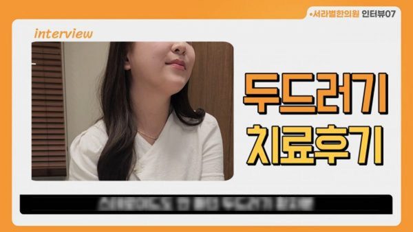 스테로이드 안듣던 두드러기 환자분 치료 사례